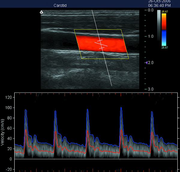 Portable 3D Ultrasound Machine Color Doppler Ultrasound Scanner with 15 Inch LED Screen