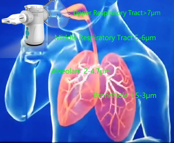 Cough Drug Durable Medical Equipment Nebulizer Mesh Portable Ultrasonic Nebulizer