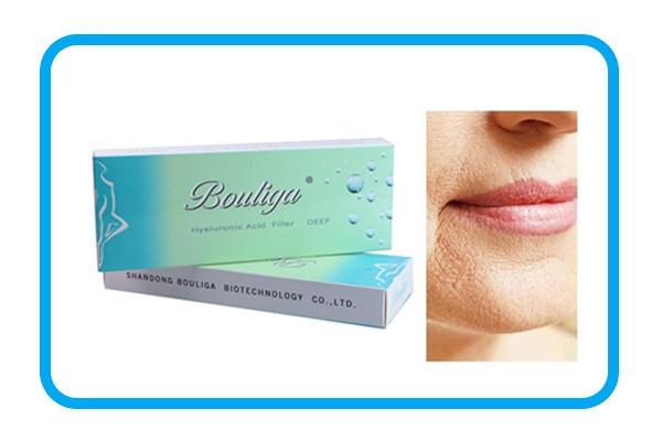 Bouliga 1ml Hyaluronic Acid Lip Fillers For Face
