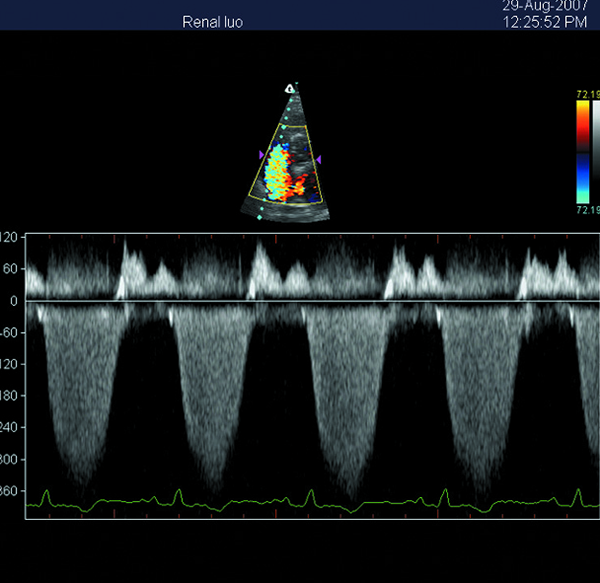 Portable 3D Ultrasound Machine Color Doppler Ultrasound Scanner with 15 Inch LED Screen