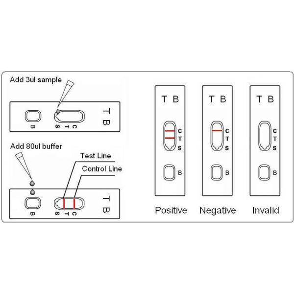 99% Tuberculosis Rapid Test Kit