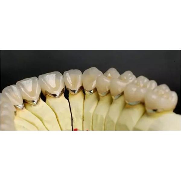 Cobalt Chrome 3D Printing Metal Powder