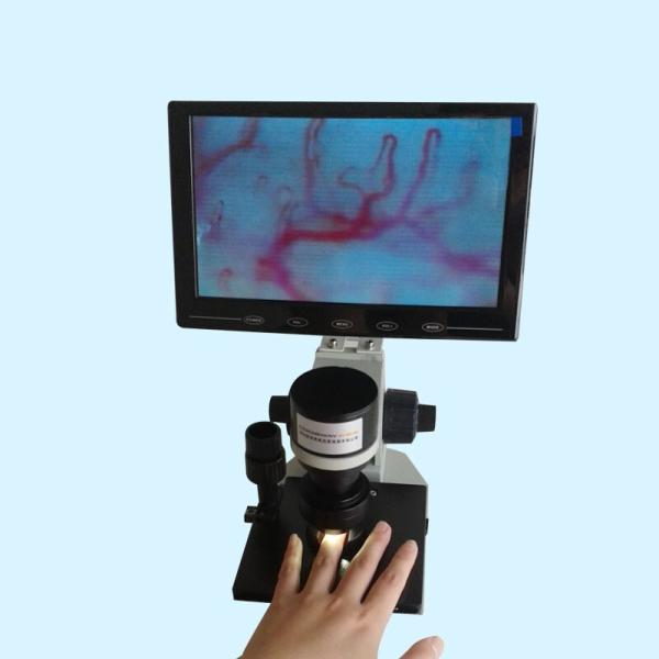 Quality Professional Nailfold Microcirculation Microscope / Nail Checking Microscopes for sale