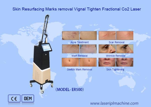 Quality Effective Fractional Laser Co2 Machine For Vaginal Treatment for sale