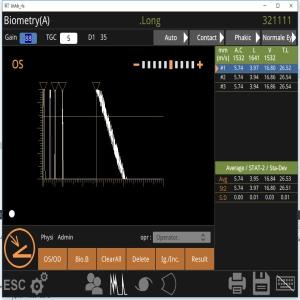 Fan Scan B Scan Machine 10MHz Observing Retinal Detachment