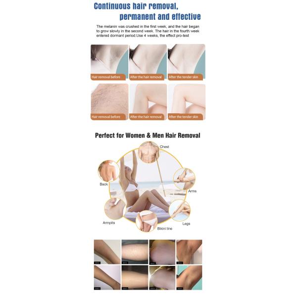 OPT SHR Hair Removal Skin Rejuvenation Beauty Machine Permanent Painless