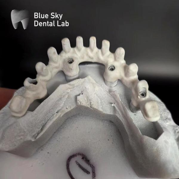 Customizable Industrial Malo Bridge In Silver And Gold Malo Implant Bridge