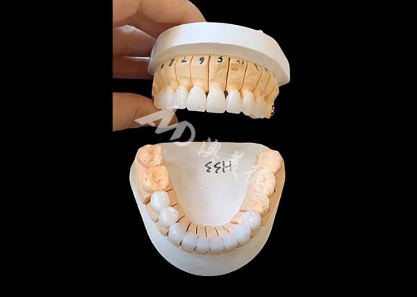 Quality Enhanced Translucency Zirconia Dental Crown For Single / Multi Unit Fixed Restorations for sale