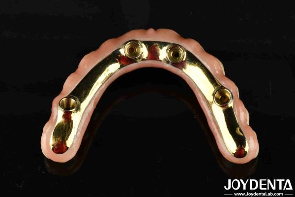 Quality Comfortable To Wear Ti-Bar Restores Chewing Function Essential Ti-Bar Zirconia Hybrid Bridge For B2B Transactions for sale