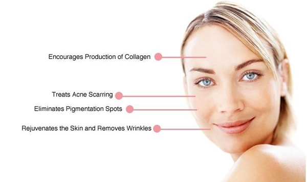 Thermal RF Fractional max 50MHz high rf output skin treatment safety and easy assignment radio frequency face lift