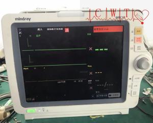 China Imec12 Icu Mindray Portable MultiParameter Patient Monitor Repair For Adult wholesale