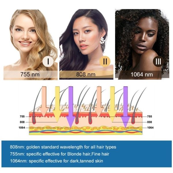 Professional Diode Laser Hair Removal Device - Smooth And Perfect Care For Your Skin