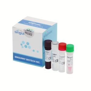 China Quantitative Diagnostic HIV Real Time PCR Kit 40uL For Human Immunodeficiency Virus wholesale