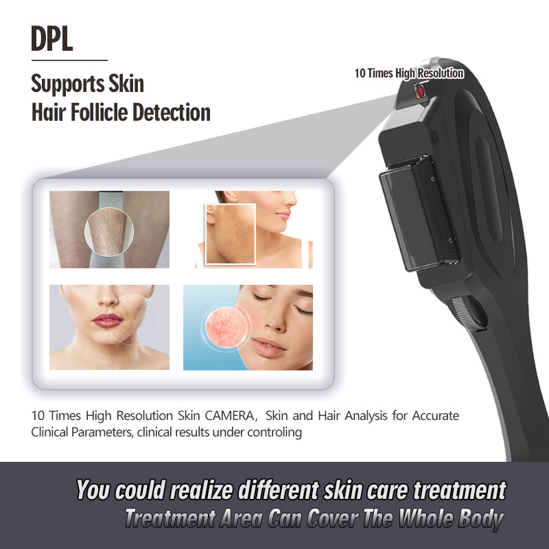 Dpl Nd Yag Q Switch 10hz Carbon Laser Peel Machine Skin Rejuvenation Tattoo Removal