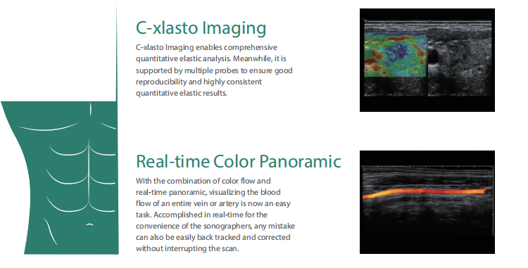 High Quality Sonoscape 4d 3d Ultrasound Machine Ultrasonido Veterinariy Human Ultrasounde Scanner