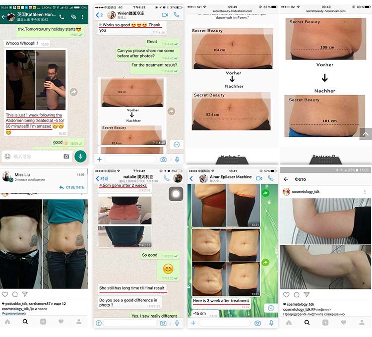 Professional 4 hands cryolipolysis cool body sculpting machine fat freezing slimming machine 360 degree for double chin 
