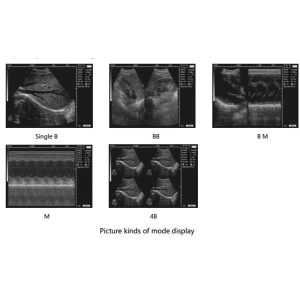5.8 inch Mobile Ultrasound Machine Fetal Doppler scanner FarmScan® L60 human