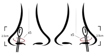 96.67% Sensitivity Ag Rapid Test Kit Lateral Flow Immunochromatography