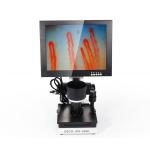 LCD Digital Biological Microscope Microcirculation Checking Capillary Microscope