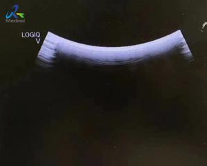 Reliable And Efficient Ultrasound Probe Repair GE 4C-RS