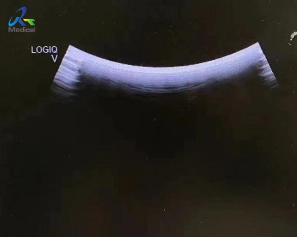 Quality Reliable And Efficient Ultrasound Probe Repair GE 4C-RS for sale