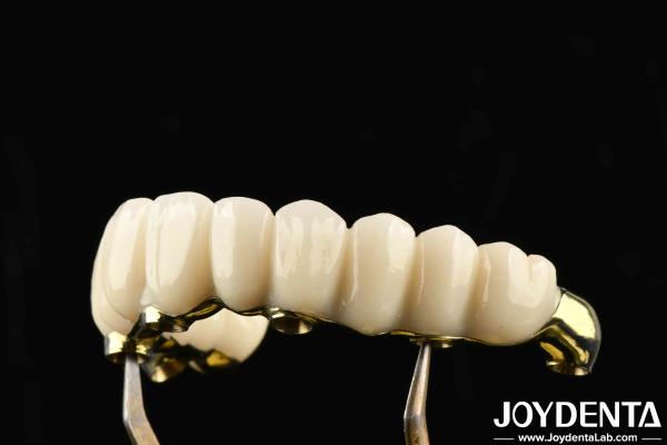 Quality Comfortable To Wear Ti-Bar Zirconia Hybrid Bridge Restores Chewing Function Compatible With Natural Teeth And Gums for sale