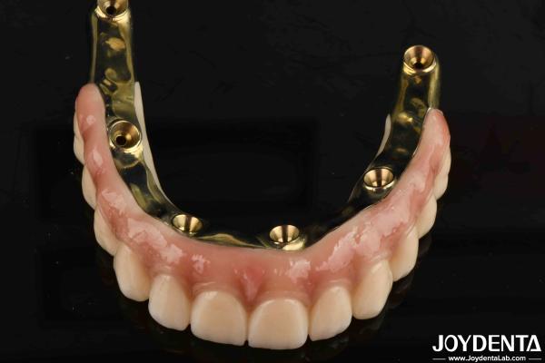 Quality Dental Prosthesis Ti-Bar Zirconia Hybrid Bridge With High Biocompatibility Standards for sale