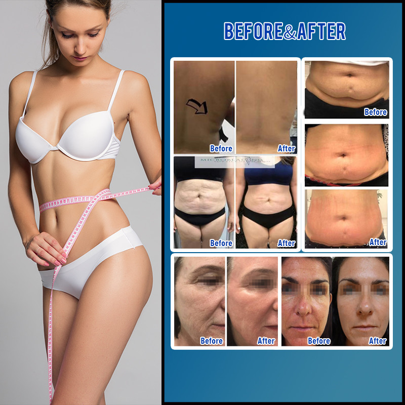 Med-360 Vela Shape Machine Multi Cavitation Slimming With Led Light 700ma No Side Effects