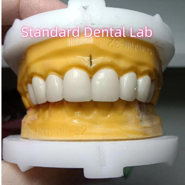 Quality Ivoclar Zirconia Crown Veneers High Translucency Esthetic for sale
