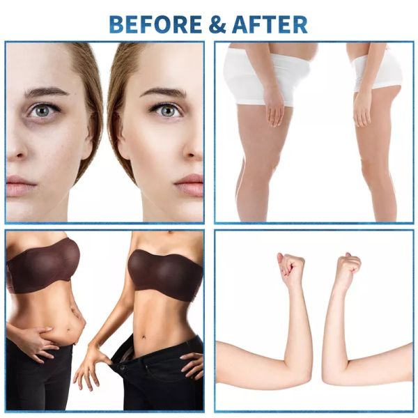 ABS Anti Cellulite Slimming Beauty Machine For Fat Reducing