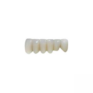 China Customized Zirconia Dental Crowns Excellent Aesthetics Durable Material wholesale