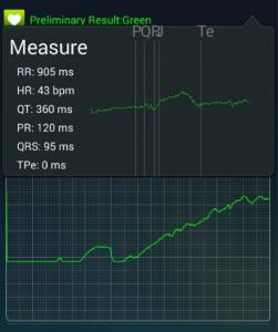 China Wecardio UN 3. ECG Event Recorder-Telemed Bluetooth EKG Mobile ECG Devices wholesale