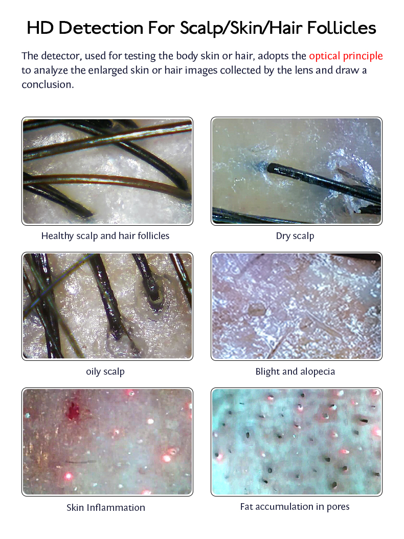 Desktop Scalp Analysis Care Machine for Skin Hair and Follicle Analysis For Commercial