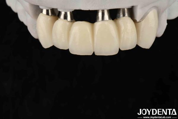 Quality Customizable Implant Crown And Bridge For Safe Oral Biocompatibility for sale