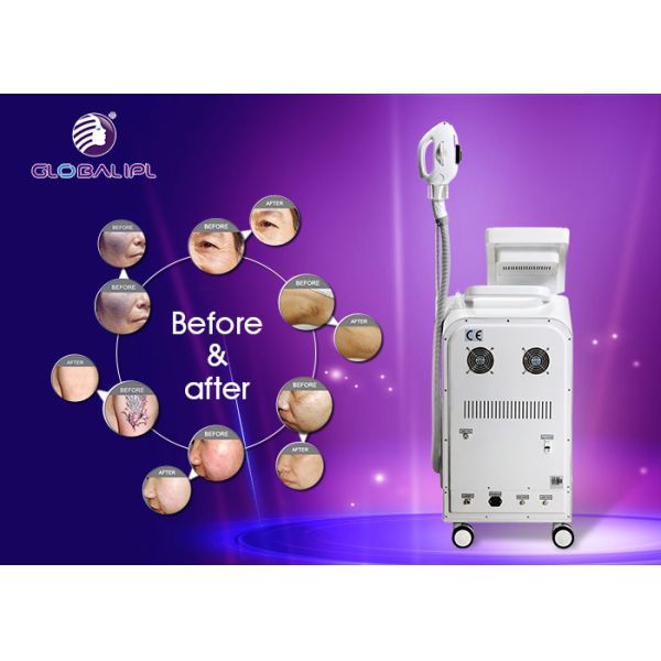 E Light / IPL RF ND YAG Laser Hair / Tattoo Removal Multifunctional Beauty Machiine 2500W Power
