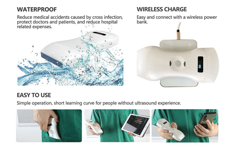 Convex Linear Phased Transvaginal Wireless 3 in 1 Portable Ultrasound Scanner Probe