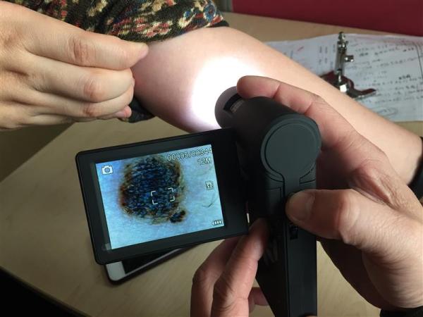 Quality LCD Screen Dermatoscope USB Digital Microscope  With High Resolution 20~230X Magnification for sale