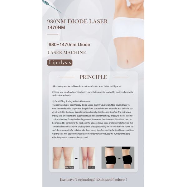 980nm Nail Fungus Removal Laser Machine Non Invasive Type Laser Treatment For Nail