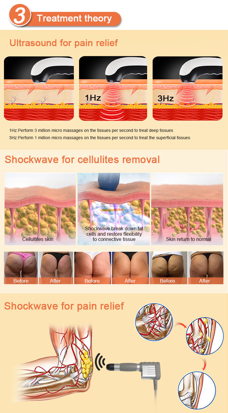 ABS Shockwave Ultrasonic Vibrating Massage Machine For Body Pain Treatment