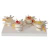 Buy cheap Vertebrae Diseased 4 Stage PVC Human Lumbar Spine Anatomy Model from wholesalers