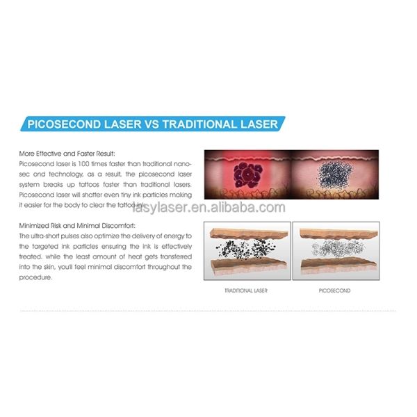 755nm 532nm picolaser Laser Tattoo Removal Machine 1064nm Microdermabrasion Device