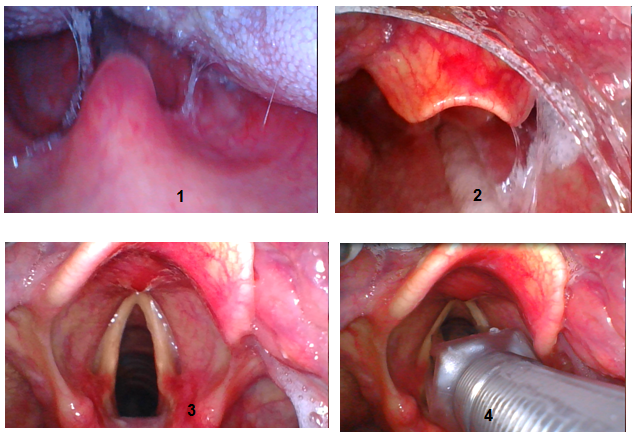 Veterinary flexible Bronchoscopy Fiber Optic Anesthesia video laryngoscopy airway pediatric stainless Miller Macintosh